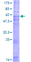 12.5% SDS-PAGE Stained with Coomassie Blue.